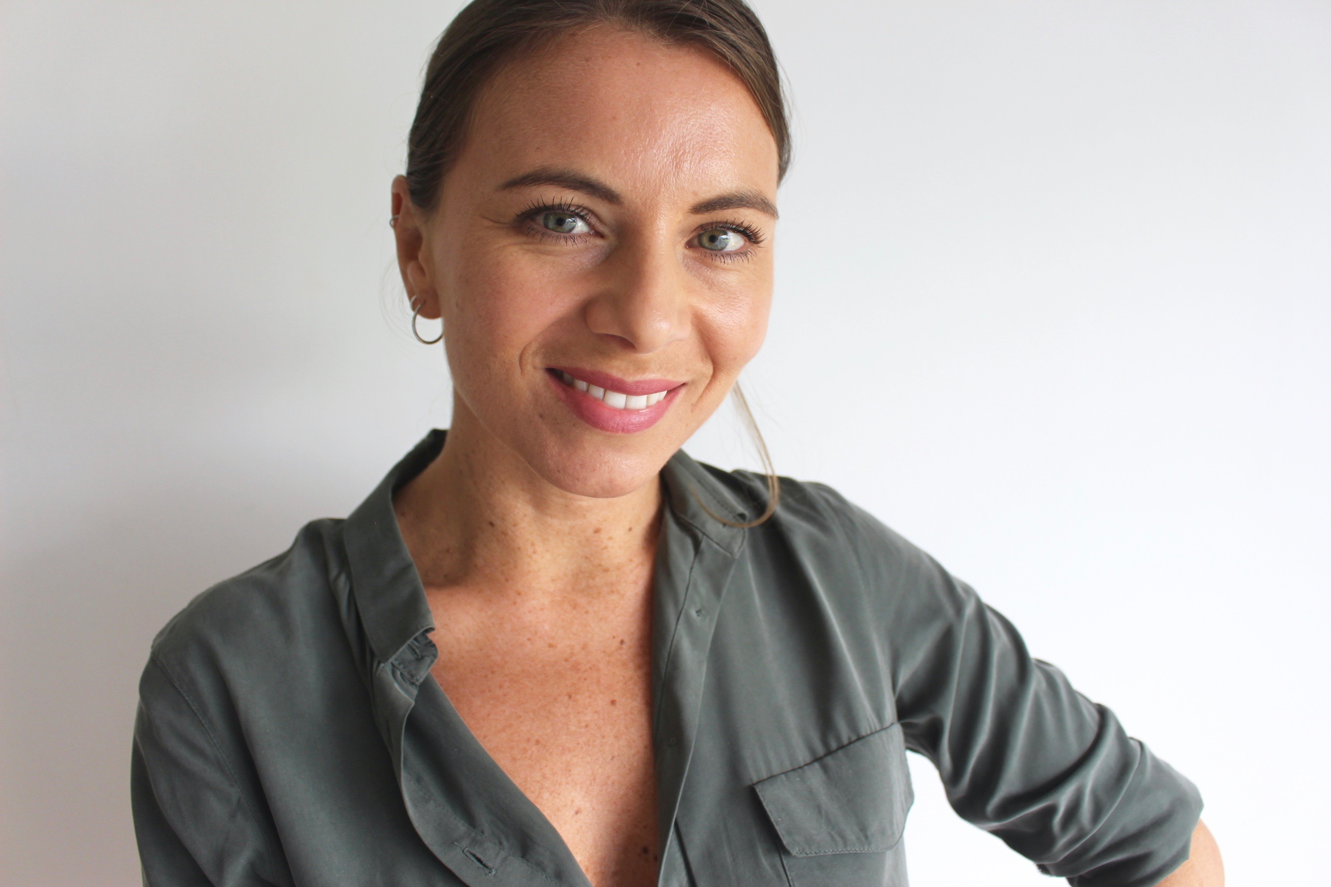 J Ai Ose Les Injections D Acide Hyaluronique Aurelie Malau Blog Mode Beaute Lifestyle